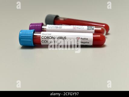 Risultato positivo del campione di sangue di analisi del coronavirus su fondo bianco. Vaccino del coronavirus. Foto Stock