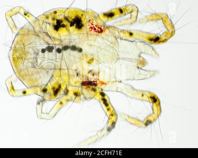 Spider Mite (probabilmente Pacific Spider Mite o Willamette Spider Mite) sotto il microscopio, il campo visivo orizzontale è di circa 0.61mm Foto Stock
