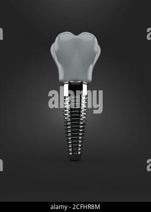 Impianto dentale isolato su sfondo grigio Foto Stock