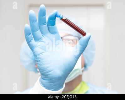 Il medico tiene la provetta con un sangue di analisi, mettere a fuoco una mano, viso sfocato. Sangue di ricerca del paziente, Foto Stock