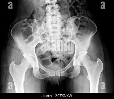 Radiografia pelvica, immagine scheletrica umana. Foto Stock
