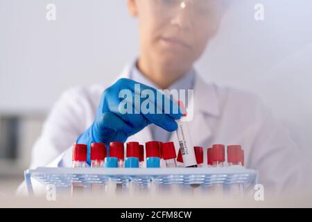 Mano guanto di matraccio femmina con analisi del sangue accanto ad altri campioni Foto Stock