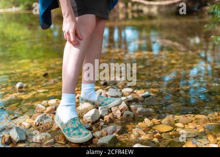 Giovane donna che graffia la gamba a causa di un morso di insetti in natura. Sullo sfondo alberi e fiume. Foto Stock