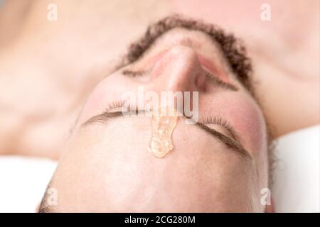 Primo piano di cera liquida tra le sopracciglia di a. giovane uomo prima di cerare in salone di bellezza Foto Stock