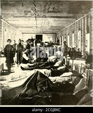 . La storia fotografica della Guerra civile : in dieci volumi . REPARTO OSPEDALIERO NEL CAMPO CONVALESCENTE AD ALESSANDRIA questo è dove migliaia di soldati fortunati hanno ottenuto bene dalle loro ferite. Quando i reggimenti si allontanarono verso la parte anteriore, i loro baracche e gli altri edifici disponibili furono trasformati in ospedali improvvisati. Quando la capacità prevista è stata superata, le tendine sono state spesso accampate per alimentare la carenza. In generale, tuttavia, altri edifici sono stati presi in consegna per provvedere il surplus feriti.questi stessi offshoots sono stati spesso costretti ad allargare e, per facilità di amministrazione, w Foto Stock