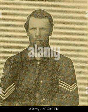 . Storia della prima batteria leggera Connecticut Volontarii, 1861-1865. Registrazioni personali e promemoria. La storia della batteria dalla sua organizzazione al tempo presente. Ferito nel braccio. In una lettera a sua sorella, il compagno Charles Hotchkiss racconta di sibilo. Le sfere si aprirono su di noi abbastanza vivaci e fecero volare la polvere, scrisse, i sacchi di sabbia furono abbattuti dal parapetto e alcuni dei theshells esplose direttamente sopra il forte. Solo uno dei nostri uomini è stato ferito e che da un proiettile attraverso il porto, dandogli una carne ferita m il ARM.The porte sono tenuti chiusi, tranne quando la pistola è scesa Foto Stock