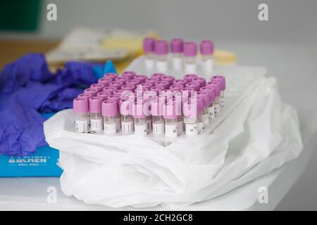 A Coruna-Spain -18 agosto 2020: Un operatore sanitario utilizza un test PCR (bocca e tampone nasale) su una persona all'interno di un'auto Foto Stock