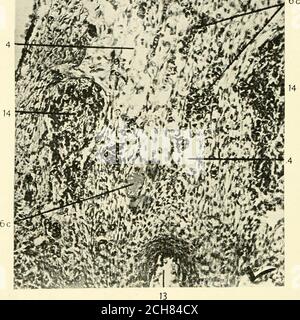 . La rivista americana di anatomia . r si differenzia dal mesenchima. Una considerazione di 448 OTTO F. KAMPMEIER. Fig. 20 sezione trasversale attraverso la regione della futura cisterna chilina a 103 mm. Embrione di maiale (serie 39, slide 12, sezione 200), X 21. 4, areasrappresentative chiare della formazione di spazi linfatici intorno alla supracardinalveno-linfatica posteriore (6c); 13, aorta; 14, tronco del nervo simpatico. le caratteristiche rivelate in 21, 22 e 23 mm. embrioni daranno sup-porto a queste osservazioni. Mentre i veno-linfatici della regione cisterna chyli sono anas-tomosing estesamente nel me Foto Stock