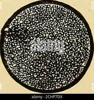 . Trattamento della malattia da correnti elettriche: Un manuale di istruzioni semplici per il medico generico. Fig. 328. Elettrodo piatto con rivestimento in spugna. Spugna morbida grande intorno all'elettrodo a mano in carbonio grande ecollegarlo al terminale galvanico positivo. Inumidire gli elettrodi per botiodi nella stessa soluzione di bicarbonato di sodio in acqua calda. Foto Stock