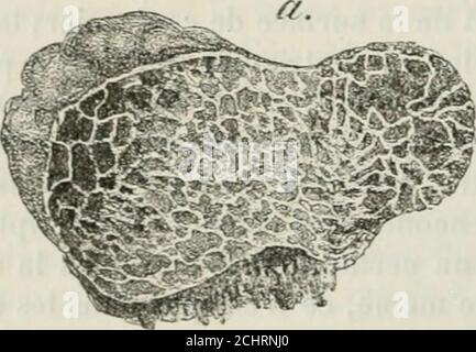 . Pathologie et thérapeutique chirurgicales générales . Foto Stock