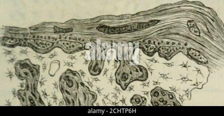 . Pathologie et thérapeutique chirurgicales générales . Fig. 55. - Coupo trasversale dun cal datanl de quarante jours sur le tibia dun lapin. Résorption aunireau de la cavité médullaire par les cellules géanteu. pposilion de tou osseux au périoste. – Grossissèment. ÎOO. Daprès Maas. Foto Stock