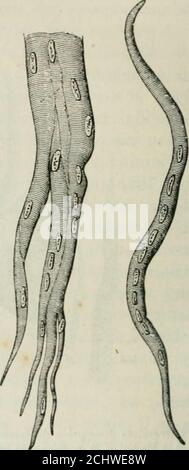 . Pathologie et thérapeutique chirurgicales générales . Fig. 21. à processus de régénération des fibers musculaires consécutifà stration trasversale,   des blessures. Grossissement, 500 environ. Préparation de Gussenbauer. tissu conjonctif de la cicatrice, comme avec les tendons; la cicatrice mus-culaire de la cantient. Daprès Weber, les jeunes fibre muscolaires types providendraient dunclivage de la substance protoplasmatique des anciens faisceaux musculaires;toutefois, cet auteur soutient quil est impossible de proiver quil ny ait[)as de fibre musculaire qui provienne, Foto Stock