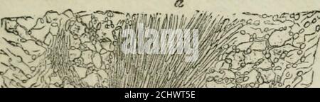 . Pathologie et thérapeutique chirurgicales générales . Fig. 10. - Coupe dune plaie par ioslrumenl tranchant faite dans la joue dun chien,vingt-quatre heures après la blessure. Grossissement, 300. Trouvent des cellules de onctif, sont déjà remplis par un grandnombre de jeunes cellules qui se sont même déjà glissées dans le sangextravasé, entre les bords de la plaie. La préparation a été traitée par lacide. mÊê Foto Stock