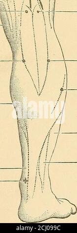 . Un trattato pratico sull'elettrodiagnostica nelle malattie del sistema nervoso . UN TRATTATO PRATICO SULLA DIAGNOSI ELECTEO NELLE MALATTIE DEL SISTEMA NEEVOUS. CAPITOLO I. Introduzione - l'elettricità come agente fisico nella diagnosi delle malattie del sistema nervoso. I progressi della medicina wliich hanno fatto durante l'ultima generazione come arte pratica e scientifica, è in grande parte il risultato dell'applicazione di agenti fisici ai fini della diagnosi. Dal periodo più arido della sua storia relativamente a tempi recenti, l'apprezzamento accurato della malattia nel soggetto di hving è stato in Th Foto Stock