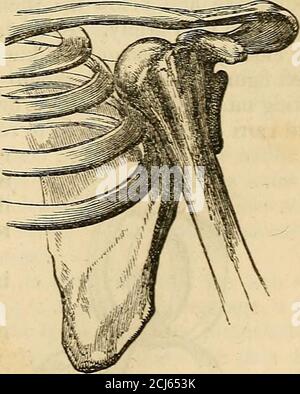 . I principi e la pratica della moderna chirurgia . • vide un caso di M. Pellieux nella Revue Medirale, agosto 1834, pag. 151, e un'altra di Brown di Callington, Med. Gaz., 1 agosto 1845.■j- Forbes Rev. Vi. 280 DISLOCAZIONE DELLA SPALLA; l'osso può essere avvertito nell'ascella, se l'arto è sollevato; anche se tale tentativo provoca grande dolore e intorpidimento. Diagnosi.- ci sono tre fratture che possono essere scambiate per disloca-zione : cioè frattura dell'acromione ; - del collo della scapola ; - e del collo dell'omero. Le prime due possono essere note dalla facilità con cui la forma del giunto Foto Stock