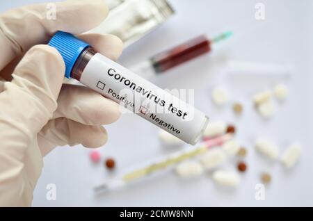 Provetta con un campione di sangue e un test negativo risultato di un'infezione da coronavirus nella mano di a. lavoratore medico Foto Stock