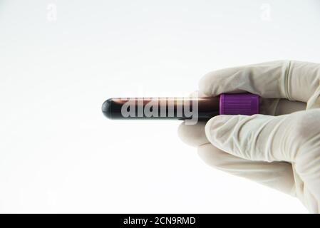 Provette per il prelievo ematico Vacutainer, provetta con EDTA per analisi CBC in laboratorio Foto Stock