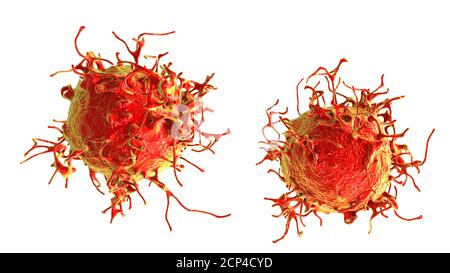 Cellula di cancro della pelle, illustrazione del calcolatore. Foto Stock