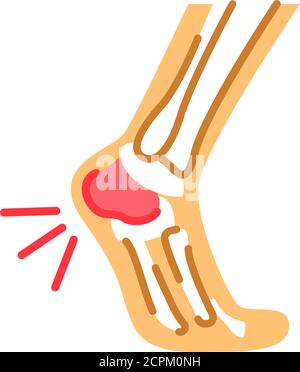 Icona del colore piatto del dolore del tallone del piede. Tallone sperone, apofisite calcanea, fascite plantare, concetto di malattia. Accedi alla pagina Web, all'app mobile, al pulsante, al logo Illustrazione Vettoriale