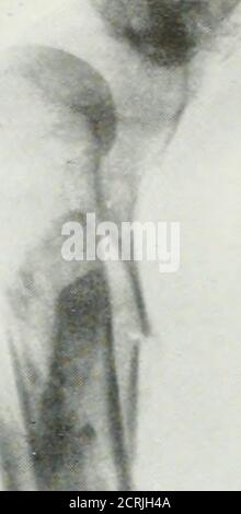 . La rivista americana di roentgoenologia, radioterapia e medicina nucleare . Foto Stock