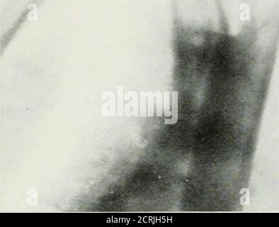 . La rivista americana di roentgoenologia, radioterapia e medicina nucleare . Foto Stock