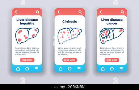 Malattie epatiche sugli schermi di onboarding delle app mobili. Illustrazione Vettoriale