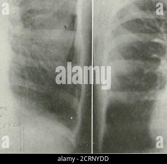 . La rivista americana di roentgoenologia, radioterapia e medicina nucleare . Foto Stock