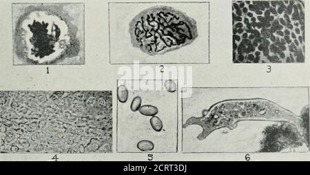 . Archivi di medicina fisica e di riabilitazione. Ed. Theymostrarono anche che un siero immune contiene da due a dieci volte superiori limiti di assorbimento nella regione dell'ultravioletto, come fa un siero normale o non-im-mune. Questo aumento dei limiti di assorbimento della lunghezza d'onda ultra-violetto nel theserum è osservato come conseguenza di irradiamenti corporei ri-peated e ex-presse, probabilmente, che cosa i medici reportano quando parlano dei generi!aumento dell'immunità incidente alle radiazioni attiniche sys-temiche. Gli spettri di assorbimento dell'emoglobina sono ben noti dalla loro perlacanza costante in trattamenti di fisiologia generale. Foto Stock