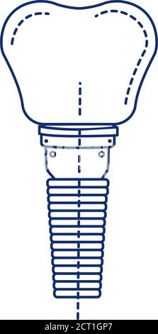 Icona della linea nera del dente dell'impianto dentale. Montante metallico che sostituisce la porzione di radice di un dente mancante. Pittogramma per pagina web, app mobile, promo. UI UX Illustrazione Vettoriale