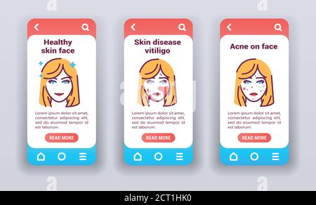 Malattie dermatologiche in faccia sulle schermate di onboarding delle app mobili. Illustrazione Vettoriale