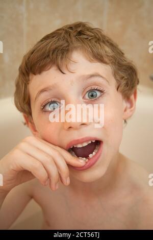 Ragazzo di cinque anni con un dente di fronte wobbly, Hampshire, Inghilterra, Regno Unito. Foto Stock