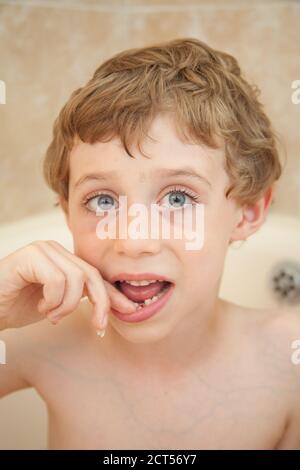 Ragazzo di cinque anni con un dente di fronte wobbly, Hampshire, Inghilterra, Regno Unito. Foto Stock