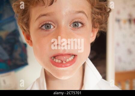 Ragazzo di cinque anni con un dente di fronte wobbly, Hampshire, Inghilterra, Regno Unito. Foto Stock