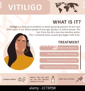 Infografiche di vitiligine. Trattamento della malattia. Silhouette donna astratta. Concetto vettoriale per sostenere le persone che vivono con vitiligine e per costruire Illustrazione Vettoriale