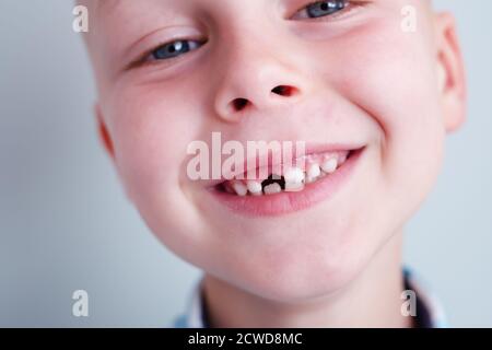 Sorridi il bambino senza il dente superiore del bambino. Un buco nel sorriso di un bambino. Cheerful concept.Health Care, igiene dentale. Foto Stock