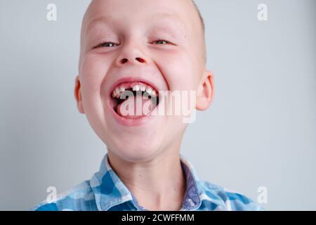 Sorridi il bambino senza il dente superiore del bambino. Un buco nel sorriso di un bambino. Cheerful concept.Health Care, igiene dentale. Foto Stock