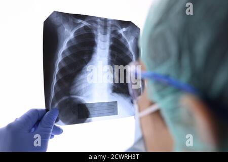 Pulmonologo in occhiali e maschera guarda ai raggi X dei polmoni in clinica Foto Stock