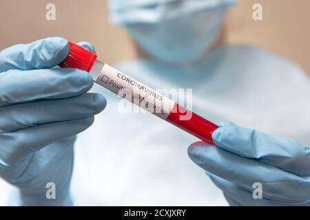 Test del sangue con coronavirus negativo. Il medico in tuta protettiva, maschera medica e guanti in lattice contiene una provetta con sangue Foto Stock