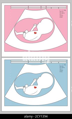 Ultrasuoni del bambino non nato nel grembo materno, ragazzo o ragazza, concetto medico, illustrazione vettoriale. Illustrazione Vettoriale