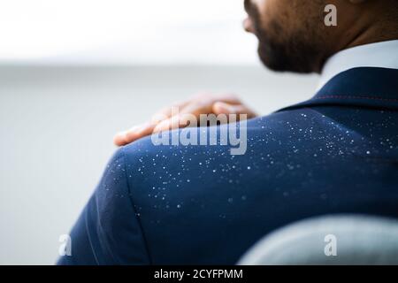 Uomo africano spazzolando Dandruff da vestito sporco Foto Stock