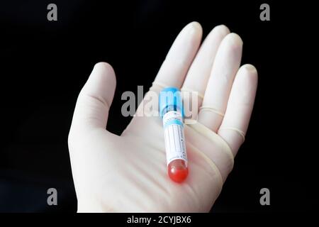 Lo scienziato tiene la provetta del campione di sangue su sfondo nero, con uno spazio per il testo. Etichetta bianca vuota per il nome del paziente o il test del sangue Foto Stock