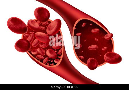 Anemia e anemia schema medico concetto come normale e anormale di cellule del sangue e di conteggio circolazione umana in una arteria o vena. Foto Stock