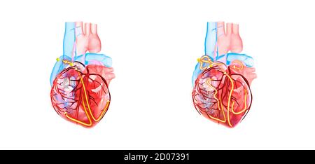 Cuore umano e sistema elettrico, illustrazione 3d. Le linee gialle mostrano il sistema elettrico (conduzione) del cuore. Il cuore di RIG Foto Stock