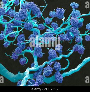 Glomeruli renali. Micrografia elettronica a scansione colorata (SEM) di un getto di resina di capillari di glomeruli e dei vasi sanguigni più grandi che li forniscono Foto Stock