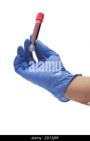 Mano che tiene il tubo di prova con sangue isolati su sfondo bianco Foto Stock