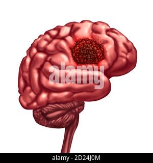 Il concetto di anatomia del cancro cerebrale e il simbolo del tumore maligno come parte del corpo di neurologia con un ingrandimento microscopico delle cellule maligne che si dividono. Foto Stock