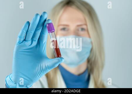 giovane donna bionda medico tiene una provetta con sangue in mano in guanti blu da vicino. Concetto di campionamento del sangue, ricerca medica e chimica Foto Stock