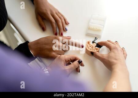 Mani di anonima donna afro-americana e dentista caucasica femminile posto sopra il tavolo durante la discussione di protesi dentali in clinica Foto Stock