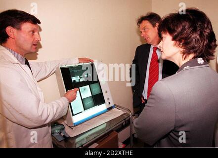 Il Dr Mike Michel (a sinistra) spiega gli esempi dei raggi X al primo Ministro Tony Blair e a sua moglie Cherie durante una visita all'unità per il cancro al King's College Hospital di Londra oggi (giovedì). Rota immagine di Fiona Hanson/PA. Vedi PA storia POLITICA Salute/Blair. Foto Stock