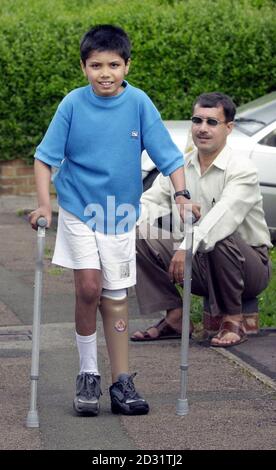 Parth Joshi, 11, la cui gamba è stata schiacciata nel terremoto indiano all'inizio di quest'anno con suo padre con suo padre Pradip Joshi , mette sulla sua nuova gamba artificiale a Tuffley, Gloucester, dopo che un ente locale 'Rapid UK' pagato per il suo volo e trattamento. Parth volò in Gran Bretagna per essere equipaggiato con la gamba protesica * dopo che il suo arto era stato manomesso nel disastro, che ha causato la morte di almeno 20,000 persone nel mese di gennaio, tra cui sua madre e suo fratello. Parth stesso è stato salvato vivo dai detriti quando è stato tirato dal relitto dopo essere stato intrappolato per 84 ore Foto Stock